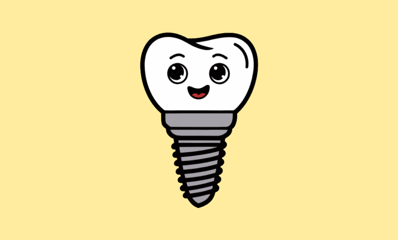dental implants in turkey
